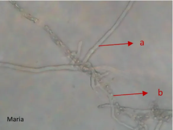 Gambar 3. Pelilitan hifa jamur Trichoderma spp. pada jamur P.  palmivora  a.  Hifa jamur Trichoderma spp., b
