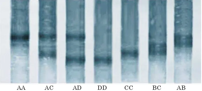 Gambar 1.  Genotipe Heat Shock Protein (HSP)-70 yang diperoleh menggunakan PCR-SSCP