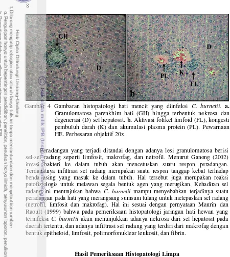 Gambar 4 Gambaran histopatologi hati mencit yang diinfeksi C. burnetii. a. 