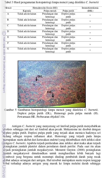 Tabel 3 Hasil pengamatan histopatologi limpa mencit yang diinfeksi C. burnetii 