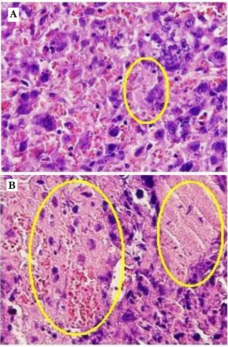 Figure 1. Fibrin deposits in placenta. Treatment group (B) shows excessive area of fibrin deposits (yellow circle) than the control group (A)