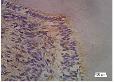 Figure 1. Immunohistochemical staining anti MMP-8 of intact tooth showed weak intensity in the cytoplasm pulp cells and extracellular matrix.