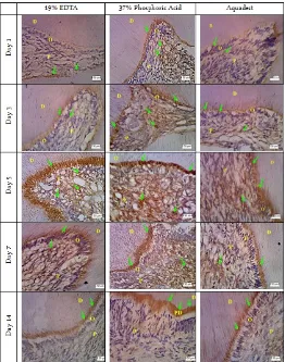 Figure 2. Immunohistochemical features showed brown staining which indicates of MMP 8 expressions