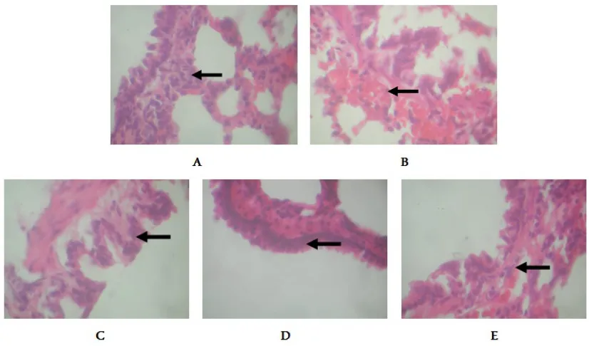 Figure 2. A. Hystology of rat's lung. Healty rat as a negative control. B..Sick rat which was exposed with benzopyrene 200 mg/Kg ofbody weight..Hystology of lung's rat exposed with benzopyerene after treatment with isolate fraction of S