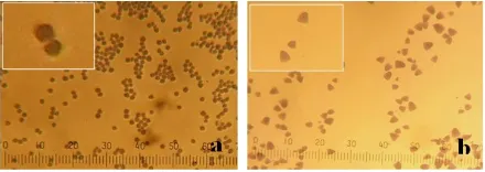 Figure 1. Morphology of starch granules from D. hispida (a)polygonal and (b) triangular