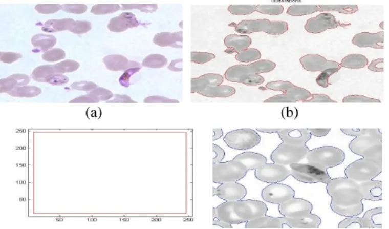 Gambar 3. Citra P. Falciparum gametocyte (a) Citra masukan; (b) Iterasi; (c) Insialisasi kurva(d)  Citra hasil segmentasi 