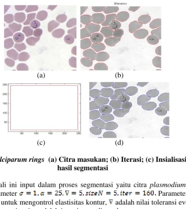 Gambar 4. Citra P. Falciparum rings  (a) Citra masukan; (b) Iterasi; (c) Insialisasi kurva (d) Citra  hasil segmentasi 