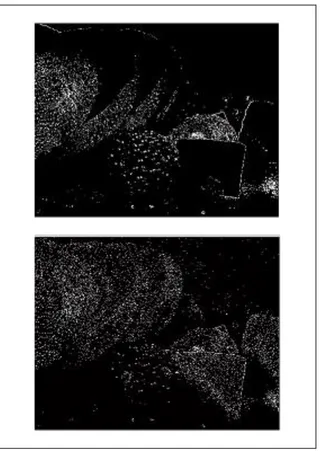 Gambar 9. Gambar Tepi Dengan Operator Prewitt, Antara Input  Tanpa Noise (Atas) Dan Input Dengan Speckle Noise (Bawah)