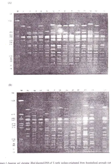 Figure 1 . Agarase gel showing Xbal digested DNA of S. tythi isolates oigirnted from hnspinlised sporadic 4,photlfever paients.(A) Lanesl-l4representrestricfbnenqnædi7estedDNApattemsofisolnte number: 55,29,39,23,49, 18,45,43,16,32,44,33,52,and 47.(B)lntes1