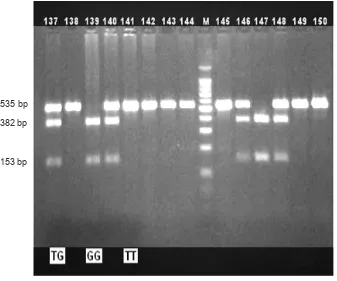 Figure 1.Fourteen representative immunoblot illustrating the main adiponectin fragments of TG, GG and TT genotype, the T allele (535 bp) and G allele (382 and 153 bp)