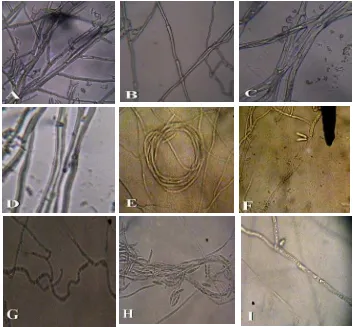 Gambar 4. Perbandingan Hifa Normal dengan Hifa Abnormal Fusarium, A. hifa normal Fusarium sp 1, B