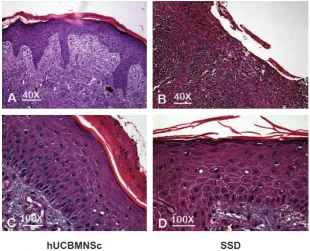 Figure 4. Histological representation of hematoxylin-eosin-stained samples of hUCBMNCs- and SSD-treatment shows epidermal layers of recovered wounds with objective magniication of 40x and 100x