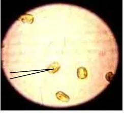 Gambar 3  Morfologi sel Chaetoceros gracilis  