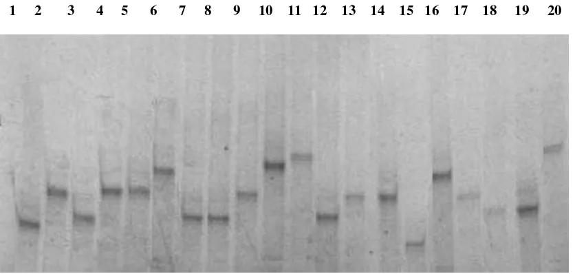 Figure 1. CAG repeat number of the AR gene in oligozoospermic/azoospermic men and normozoospermic men