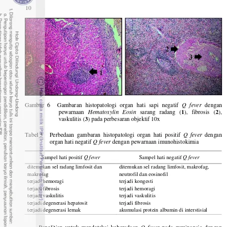 Gambar 6  Gambaran histopatologi organ hati sapi negatif Q fever dengan 
