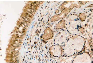Gambar 2.3.1 Cyclooxygenase-1 ditemukan 2+ pada pewarnaan sitoplasma 