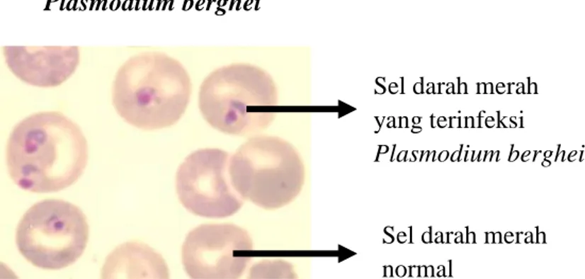 Gambar 3. Bentuk sel darah merah yang terinfeksi Plasmodium berghei  ( http://en.wikipedia.org/wiki/Plasmodium_berghei )  Klasifikasi ilmiah Kingdom  : Protista  Filum    : Apicomplexa  Kelas    : Aconoidasida  Ordo    : Haemosporida  Family   : Plasmodiid