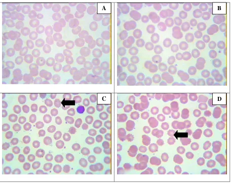 Figure 1. Illustration of erythrocyte ). Arrows indicate echinocytes. In control group (without  Na2EDTA) (A) and group with standard anticoagulant (B),  echinocytes are very rare