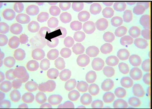 Figure 2. Photograph; erythrocytes ghost cell (specimen of morphology examination) 