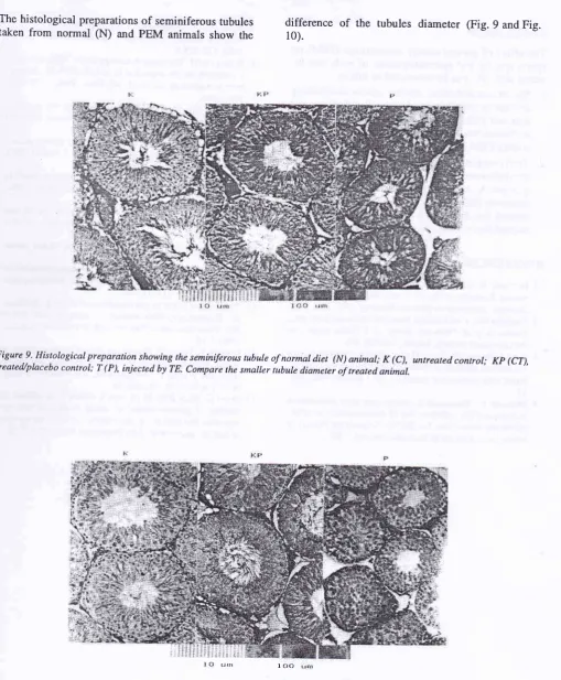 Figure 9' treated,/placebo Histological preparation showing the seminiferous tubule of normal diet (N) animal; K (C), untreated control; Kp (CT),control; T (P), injected by TE