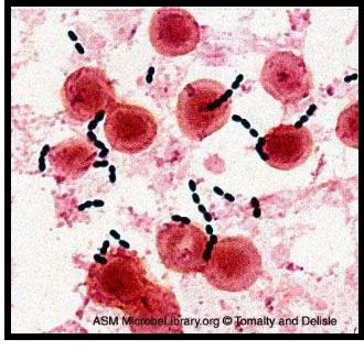 Gambar 1. Koloni Enterococcus faecalis  dengan scanning electron microscope. 24 
