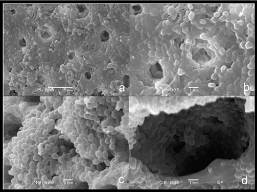 Gambar 3.  Scanning electron microscopy (a,b) Saluran akar tertutup oleh biofilm E.faecalis (c,d) agregasi sel bakteri ke tubulus dentin