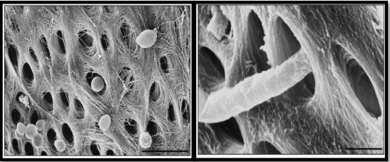 Gambar 1. Scanning electron dari blastospora C. albicans (A) dan (B) penetrasi hifa     ke dalam tubulus dentin pada saluran akar in vitro.8  