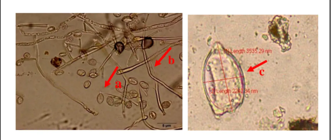 Gambar  1  Hasil  uji  mikroskopis  pada  tanaman  kentang  yang  terserang  Phytopthora  infestans  (Hawar  daun  kentang),  Keterangan  :  Gambar  a)