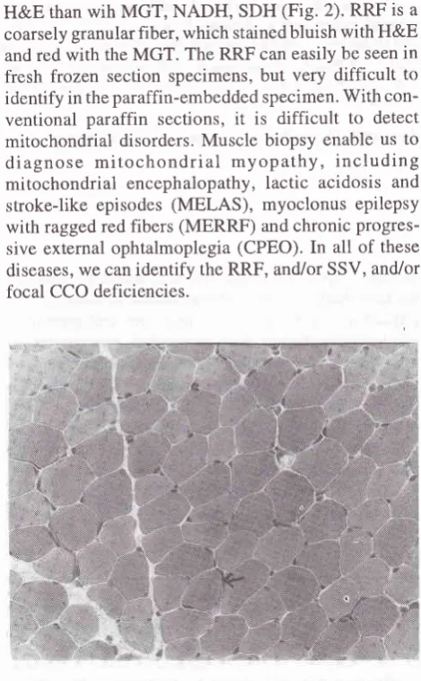Figure l. Myotubular myopathies, H&E staining, 40x, H&E =hematoryclin & eosin