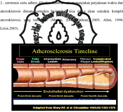 Gambar 2.1. Perjalanan waktu aterosklerosis (Leeson,2001) 