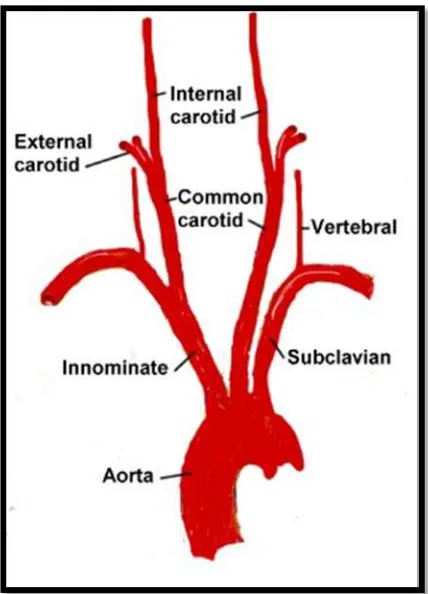 Gambar 1. Gambaran anatomi normal Arteri Karotid4 