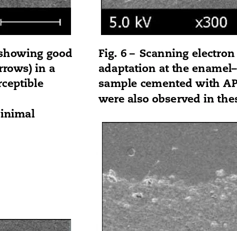 Fig. 6 – Scanning electron microscopy image showing goodadaptation at the enamel–cement interface (arrows) in asample cemented with AP + U