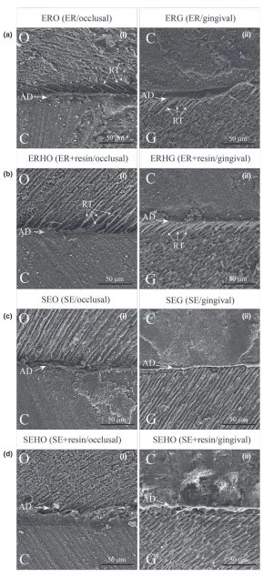 Figure 3. Representativescanningelectronmicroscope images of the composite–toothinterfaces bonded with universal adhesive