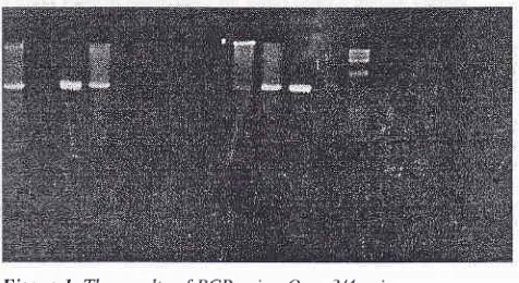 Figure 1. The resuhs ltositive narker of PCR using Omp 3/4 primerTlte first Lane showed black band of S