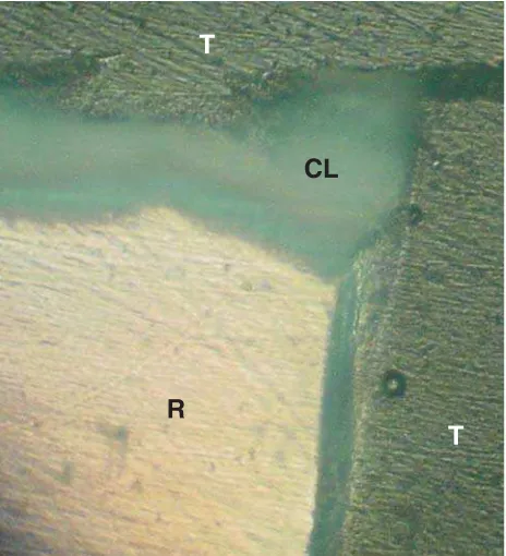 TABLE 3- Correlation between the variables studied and white spot lesion formation