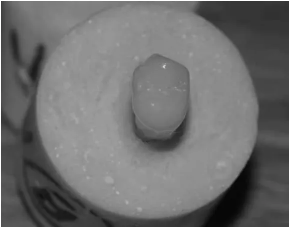 Figure 2 Milled crown seated on prepared