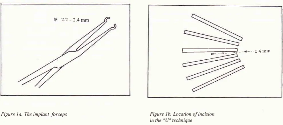 Figure la. The inplant forceps