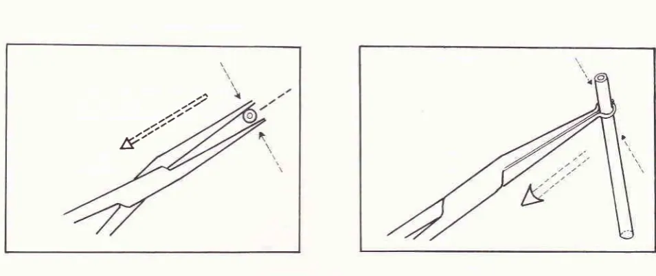 Figure 3. The position of the silastic tube of implant in the tip of tnosquito forceps (3a) and implanr forceps (3b)