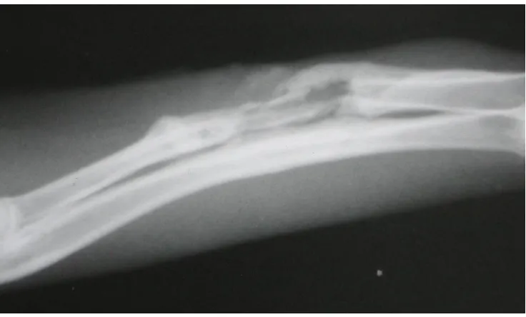 Figure 1. Clinical appearance of one of the samples’ limb with osteomyelitis. An inflammation and a fistula were found 