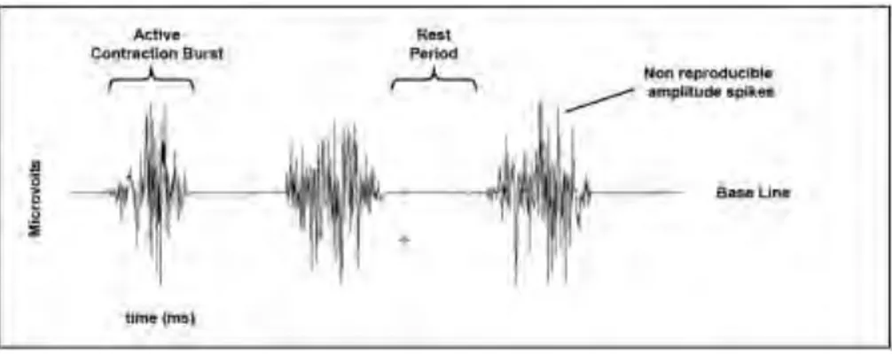 Gambar 2.6  Raw Sinyal EMG (Konrad, 2005) 