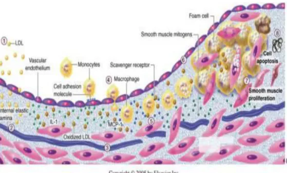 Gambar  2.7.  Proses  aterosklerosis  dan  pembentukan  Foam  Cell  (Ken  dkk,  2011;).