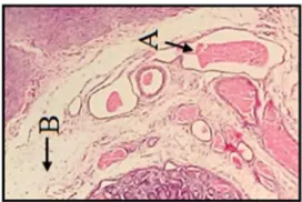 Gambar 2. Pemeriksaan makroskopis usus anak babi landrace yang terkena  colibacillosis