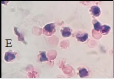Gambar 4. Pemeriksaan mikroskopis usus anak babi landrace yang terkena colibacillosis