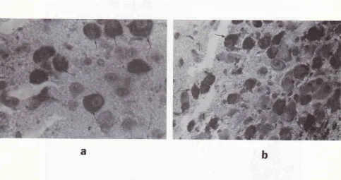 Figure 11. StreptAvidin-Biotin staining neurosecretory neurosecretory systen Photonicrograph ofafrontal section ofthe rat brain at the stereotaxic coordinates berween IA 7,60 ntnr and bregnrc -1,40 mm, and IA 7,20 mm andbregma - 1,80 nm showing an example 