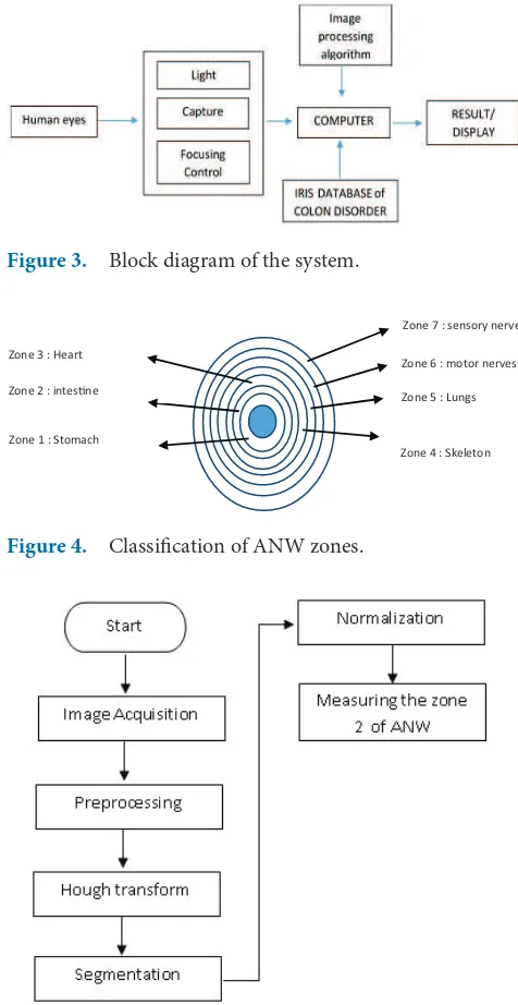 Figure 4. Classiication of ANW zones.