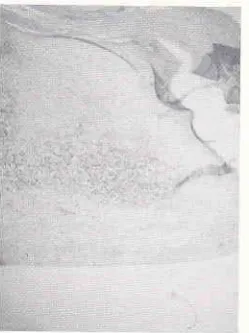 Figure 4. Figure 3 fron close up.
