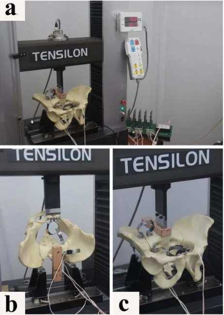Figure 1. Overview of the biomechanical test procedure. a)Tensilon® RTF-1310 connected to registrar LabView® Signal Express; b) anteroposterior load test; c) axial load test