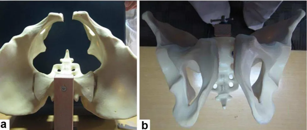 Figure 3. Anteroposterior projection of pelvic X-ray demonstrating fixation types in each group