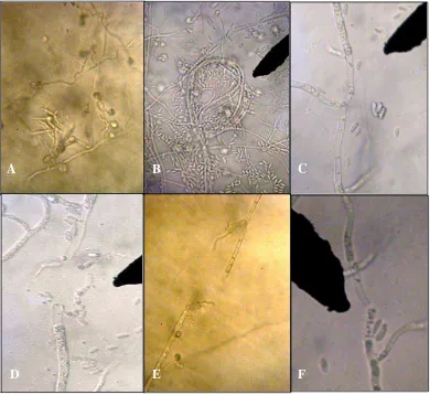 Gambar 3.4 Pengamatan fungi abnormal secara mikroskopik; A. Miselium                        bengkok; B