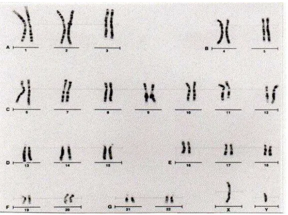 Gambar 3. Karyotipe kromosom manusia (laki-laki) 